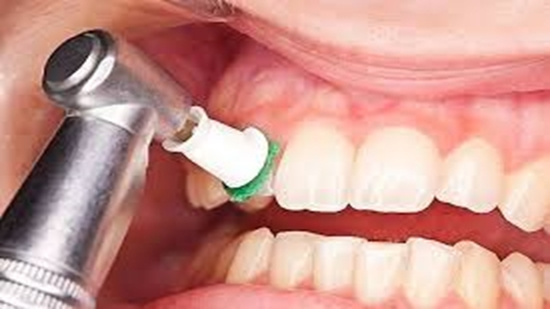 جرمگیری مینای دندانتان را تحلیل میبرد؟