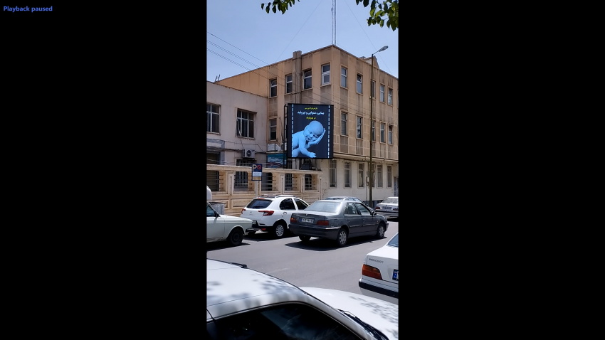 نیاز هر نوزاد بررسی بینایی، شنوایی و تیروئید در بدو تولد